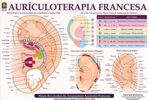 auriculoterapia